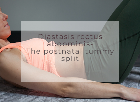 Diastasis rectus abdominis- The postnatal tummy split